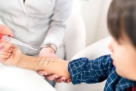 Food Allergy Tests for Kids: What You Need To Know